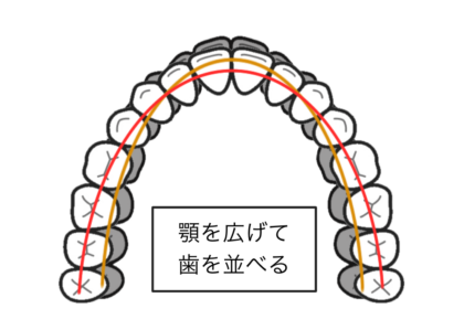 前方、側方拡大