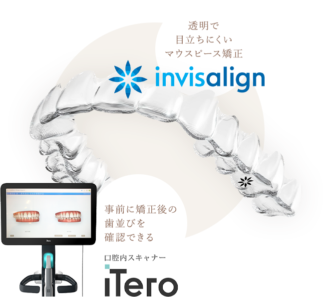 invisalign（インビザライン） マウスピース矯正