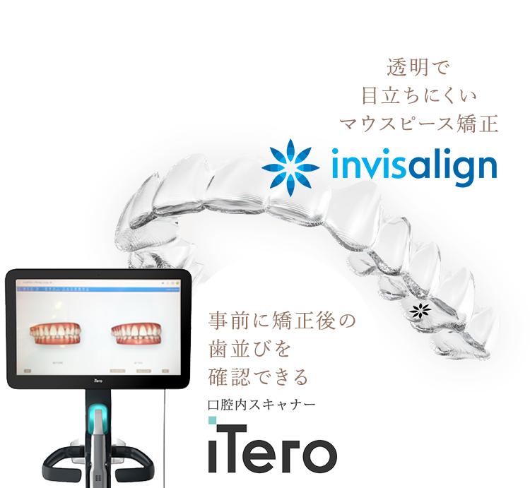 invisalign（インビザライン） マウスピース矯正