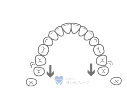 遠心移動