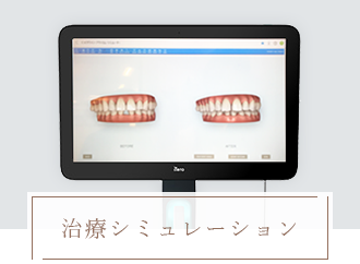 治療シミュレーション 