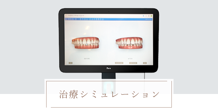治療シミュレーション 
