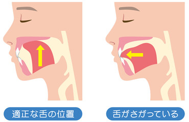 正しい舌の位置